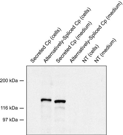 Western Blot Of The Cells And Conditioned Media Of Transfected Cells