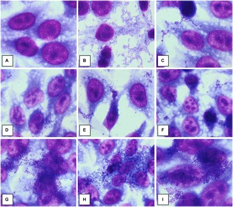 Adherence Patterns To HeLa Cell Substrate A No Adherence B