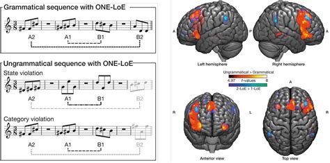 Comment Le Cerveau D Code T Il La Musique Planet Vie