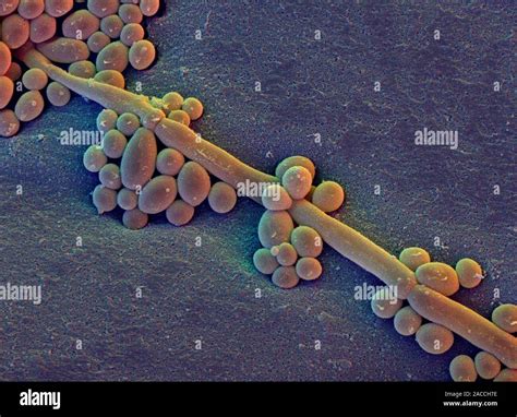 Candida Albicans Coloured Scanning Electron Micrograph Sem Of The