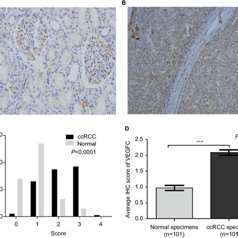 The Mrna And Protein Expression Of E Bp In Ccrcc Notes The Mrna