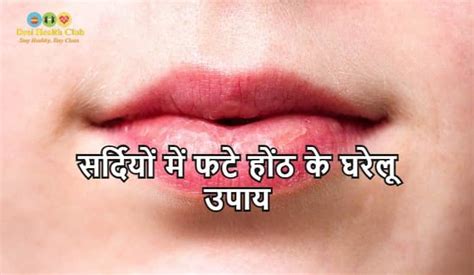 सर्दियों में फटे होंठ के घरेलू उपाय Home Remedies For Dry Lips In Winter