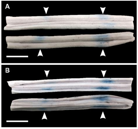 Blood Spinal Cord Barrier Opening Confirmed By Evans Blue Dye Ebd