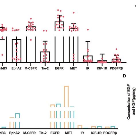 Egfrmet Were Highly Expressed In Hcc Tissue And Hcc Cell Lines