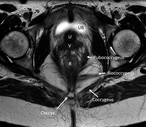 Os Coccygeus