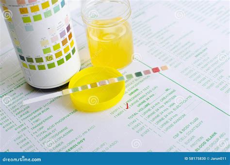 Urine Analysis Stock Photo Image Of Biology Urine Test