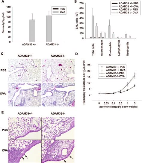 Phenotypic Features Of Asthma In Mice Are Not Significantly Affected By