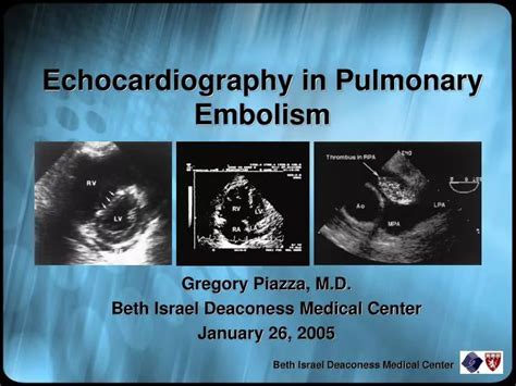 Ppt Echocardiography In Pulmonary Embolism Powerpoint Presentation