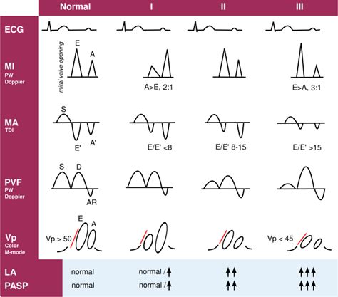 Diastolic Function Echopedia