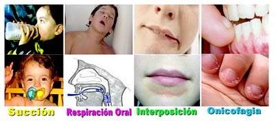 Clinica Dental Boca Boca M Laga Odontopediatria Mal Posiciones