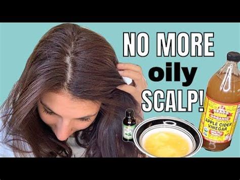 Diy Hair Mask For Oily Hair Super Oily Hair Oily Hair Care Diy Hair