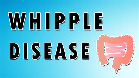 Whipple Disease Symptoms Treatment And Causes Youtube