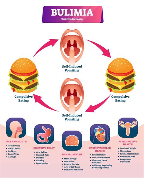 Medical Complications Associated With Bulimia Nervosa The Center For