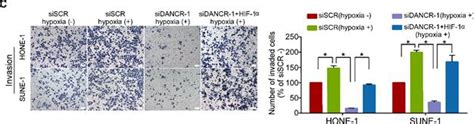 Long non coding RNA DANCR stabilizes HIF 1α and promotes metastasis by