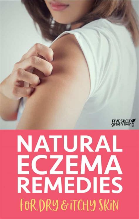 Natural Eczema Treatment - Five Spot Green Living