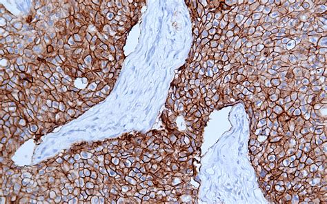 Her Rabbit Monoclonal Antibody Mab Ihc Buy Now