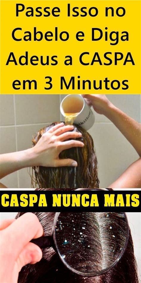 Passe Isso No Cabelo E Diga Adeus A Caspa Em Minutos Caspa Receita