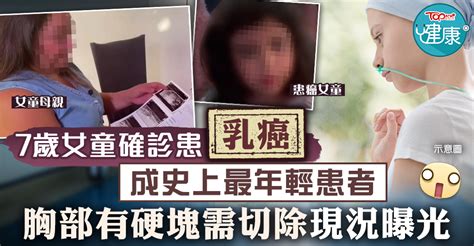 【癌症殺手】7歲女童患乳癌成史上最年輕患者 胸部有硬塊需切除