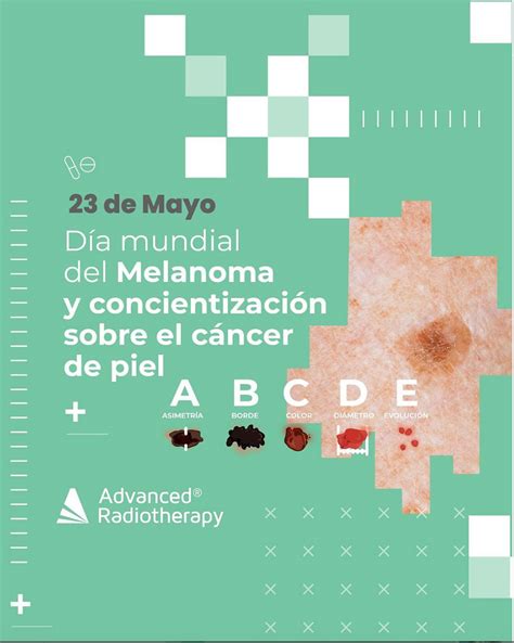 Día Mundial Del Melanoma Y Concientización Sobre El Cáncer De Piel