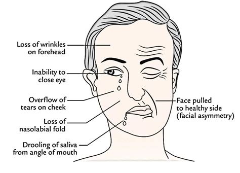 Orbicularis Oris: Origin, Insertion, Blood Supply, Function