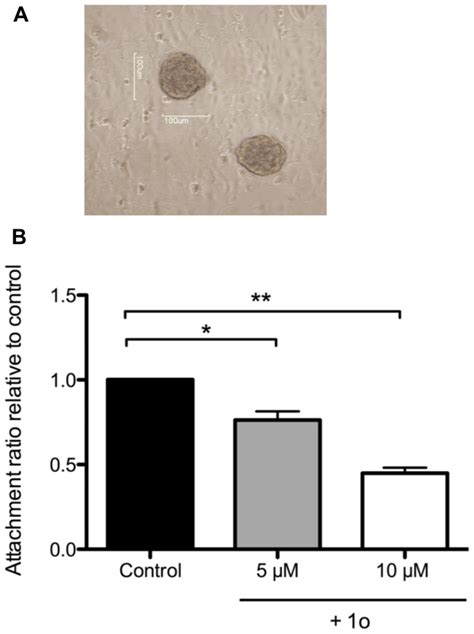 B Inhibition Of The Receptivity Of Endometrial Epithelial Cell Line