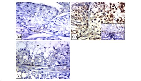 Photomicrographs Of Rat Testis Immunostained For Caspase 3 A Control