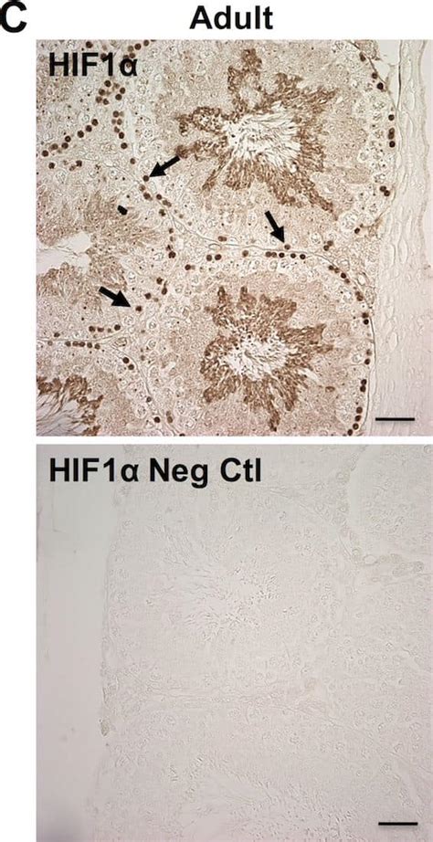 HIF 1 Alpha Antibody BSA Free NB100 479 Novus Biologicals