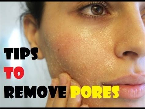 How To Minimize Pores On Face Naturally Youtube