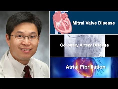 Doctor Q A Complex Mitral Valve Surgery With Dr Wilson Szeto