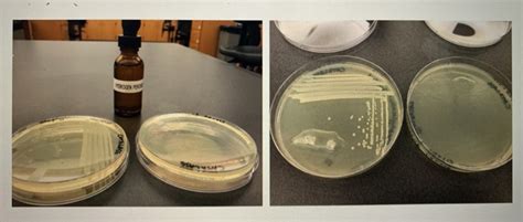 Solved Results 1 Starch Hydrolysis Record Your Results And