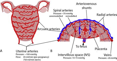 Understanding Abnormal Uterine Artery Doppler Waveforms A Novel