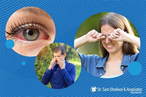 Protecting your eyes from seasonal allergies - Dr. Sam Dhaliwal ...