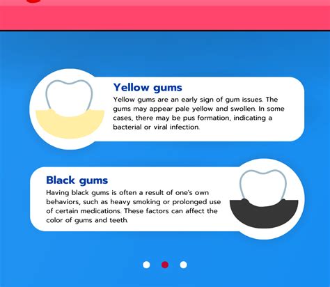 Did You Know The Color Of Gums Can Indicate Health Issues