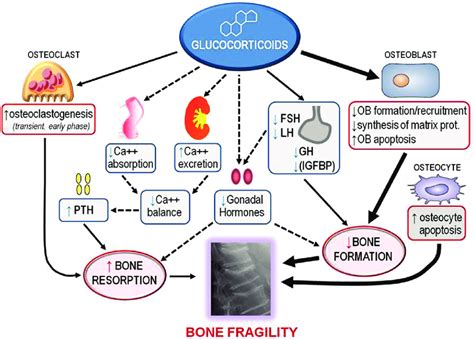 Pathogenesis Of Glucocorticoid Induced Osteoporosis Glucocorticoid