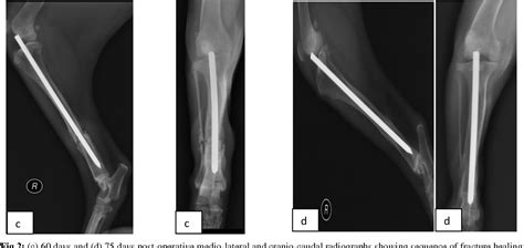 Pdf Evaluation Of Intramedullary Pinning Technique For Management Of