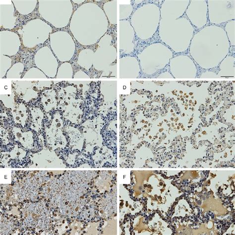 Representative Results Of Immunoperoxidase Staining For Fas And Fasl In