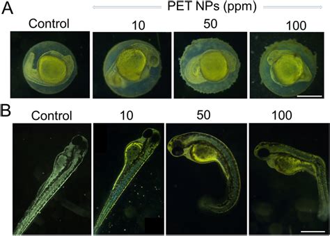 Representative Images Showing The Effect Of PET NPs On Early Stages Of