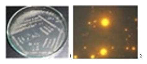 Macro And Microscopic Morphology Of The Colonies Of Strains A B