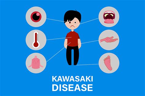 ThinkAnswers Net Kawasaki Disease Causes And Symptoms