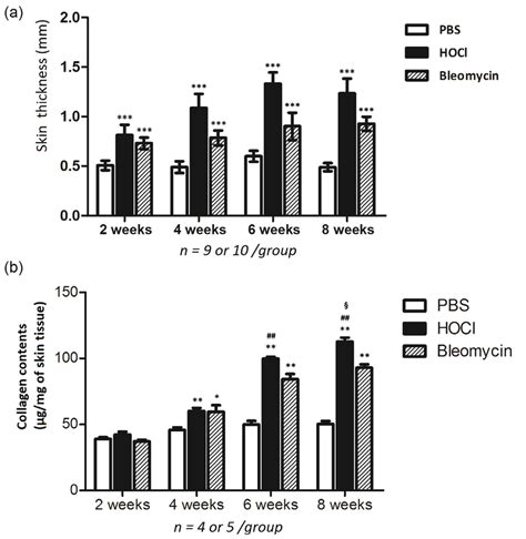 A Skin Thickness In Mice Skin Thickness At Injected Zone Was