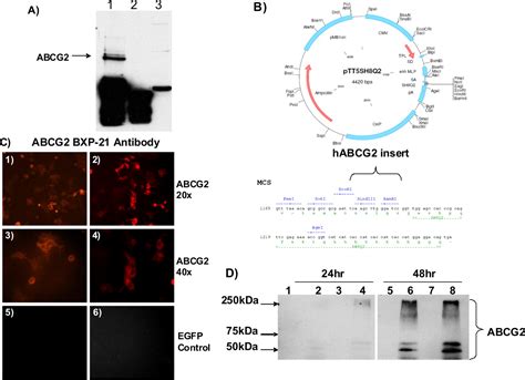 abcg  upregulated  alzheimers brain  cerebral amyloid