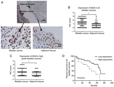 Downregulation Of BLM RecQ Helicase Inhibits Proliferation Promotes