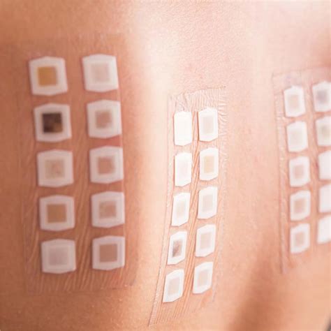 Dermatological Tests Patch Tests GBA POLSKA