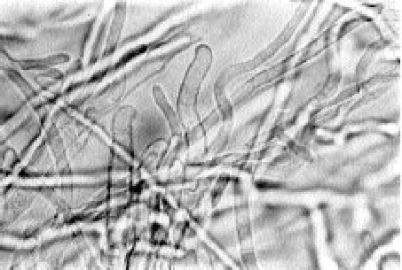 Helically Twisting Macroconidia Formed Among Helically Twisting Hyphae