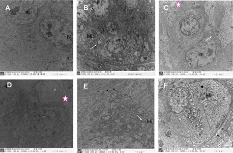 The Transmission Electron Microscopy Of Testis Sertoli Cell In