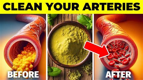 Top 10 Spices To Clean Your Arteries And Prevent Heart Attack Naturally