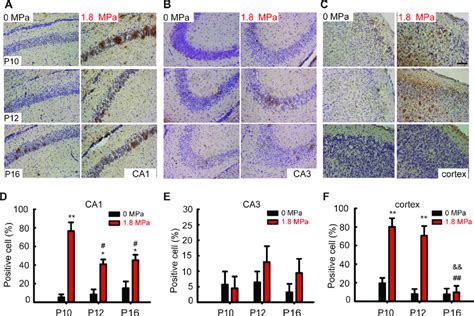 The Expression And Distribution Of Caspase Positive Cell In The Brain