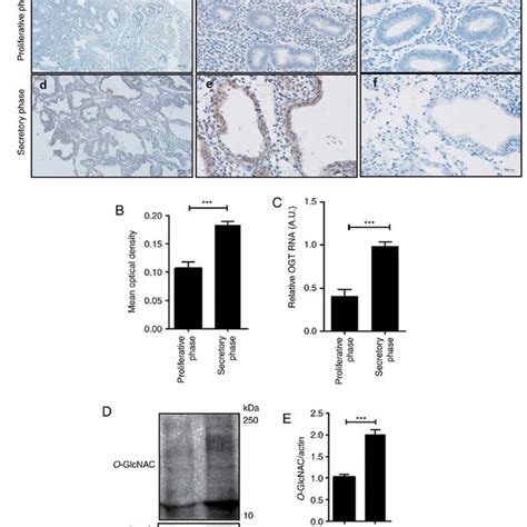 Expression Of O Glcnac Modified Proteins In Human Endometrial Tissue