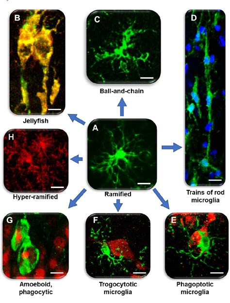 Figure From Phenomic Microglia Diversity As A Druggable Target In The