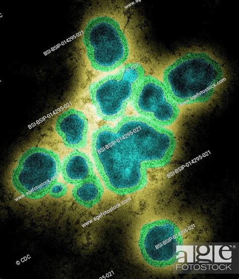 This Digitally Colorized Negative Stained Transmission Electron